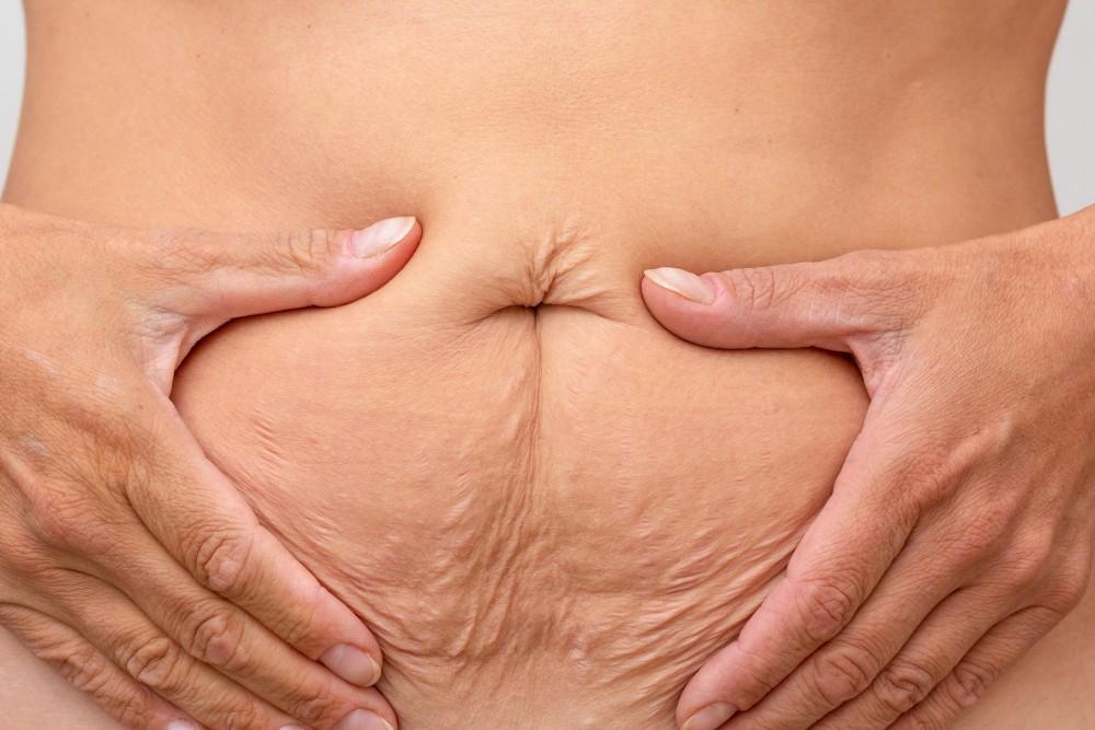Weight Loss Injections